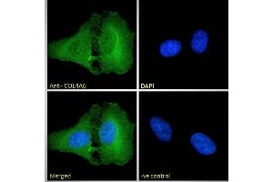 COL4a6 antibody  (Internal Region)