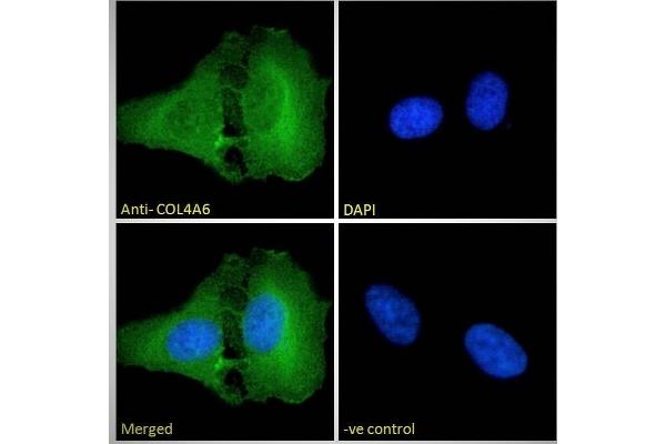 COL4a6 antibody  (Internal Region)