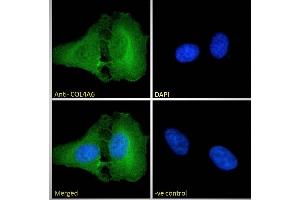 ABIN570771 Immunofluorescence analysis of paraformaldehyde fixed U2OS cells, permeabilized with 0.