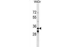 Western Blotting (WB) image for anti-Integrin beta 1 Binding Protein (Melusin) 2 (ITGB1BP2) antibody (ABIN2999936) (ITGB1BP2 antibody)