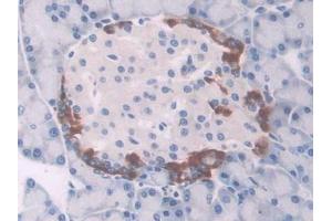 IHC-P analysis of Rat Pancreas Tissue, with DAB staining. (UCP1 antibody  (AA 179-296))