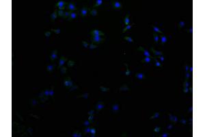 Immunofluorescence staining of A549 cells with ABIN7156172 at 1:100, counter-stained with DAPI. (RHBDF2 antibody  (AA 1-200))