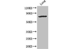 Western Blot Positive WB detected in: Mouse lung tissue All lanes: SLC28A3 antibody at 3 μg/mL Secondary Goat polyclonal to rabbit IgG at 1/50000 dilution Predicted band size: 77, 70 kDa Observed band size: 77 kDa