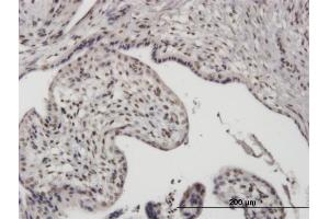 Immunoperoxidase of monoclonal antibody to UBTF on formalin-fixed paraffin-embedded human placenta.