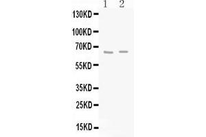 Western blot analysis of GAD65 expression in rat brain extract ( Lane 1) and mouse brain extract ( Lane 2). (GAD65 antibody  (N-Term))