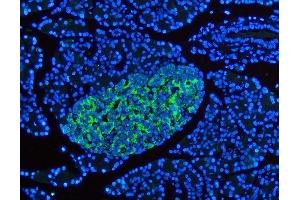 IF analysis of SYP using anti-SYP antibody (ABIN3042768).
