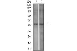 Western Blotting (WB) image for anti-Purinergic Receptor P2Y, G-Protein Coupled, 1 (P2RY1) antibody (ABIN5611276)