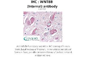 Image no. 1 for anti-Wingless-Type MMTV Integration Site Family, Member 8B (WNT8B) (Internal Region) antibody (ABIN1740842) (WNT8B antibody  (Internal Region))