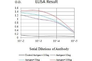 Black line: Control Antigen (100 ng),Purple line: Antigen (10 ng), Blue line: Antigen (50 ng), Red line:Antigen (100 ng) (Cytokeratin 18 antibody  (AA 1-150))