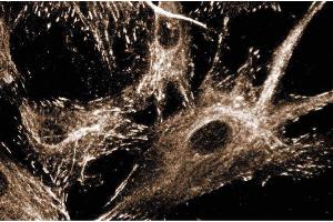 Immunofluoresence staining of human fibroblasts. (Paxillin antibody  (AA 1-557))