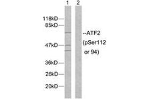 Western blot analysis of extracts from MDA-MB-435 cells, using ATF2 (Phospho-Ser112 or 94) Antibody. (ATF2 antibody  (pSer112))