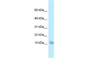 WB Suggested Anti-Nme1 Antibody Titration: 1. (NME1 antibody  (C-Term))