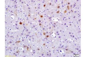 Formalin-fixed and paraffin embedded rat brain labeled with Rabbit Anti phospho-Pyk2/PTK2B(Tyr402) Polyclonal Antibody, Unconjugated (ABIN745763) at 1:200 followed by conjugation to the secondary antibody and DAB staining