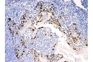 Anterior Gradient 2 was detected in paraffin-embedded sections of  human tonsil tissues using rabbit anti- Anterior Gradient 2 Antigen Affinity purified polyclonal antibody (Catalog # ) at 1 µg/mL. (AGR2 antibody  (AA 21-175))