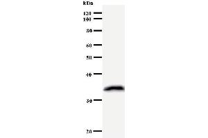Western Blotting (WB) image for anti-Kinesin Family Member 2C (KIF2C) antibody (ABIN931054) (KIF2C antibody)