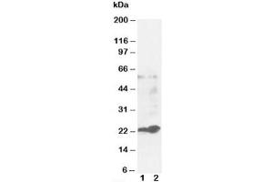 Western blot testing of GST pi antibody and Lane 1:  MCF-7 (Glutathione S Transferases pi antibody)
