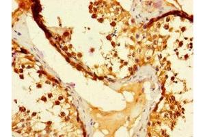 Immunohistochemistry of paraffin-embedded human testis tissue using ABIN7173524 at dilution of 1:100 (DUS3L antibody  (AA 221-409))