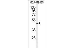 Western blot analysis in MDA-MB435 cell line lysates (35ug/lane). (GDF5 antibody  (C-Term))