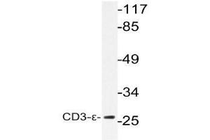 Western blot (WB) analysis of CD3-epsilon antibody in extracts from K562 cells. (CD3 antibody)