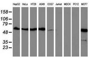 Image no. 2 for anti-Sequestosome 1 (SQSTM1) antibody (ABIN1499989) (SQSTM1 antibody)