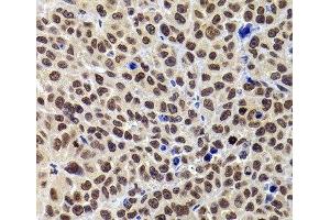 Immunohistochemistry (Paraffin-embedded Sections) (IHC (p)) image for anti-Pleckstrin Homology Domain Interacting Protein (PHIP) antibody (ABIN7263187)