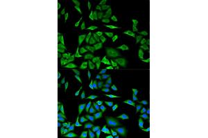 Immunofluorescence analysis of MCF-7 cells using DBI antibody. (Diazepam Binding Inhibitor antibody)