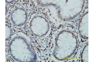 Image no. 2 for anti-General Transcription Factor IIIC, Polypeptide 2, beta 110kDa (GTF3C2) (AA 1-912) antibody (ABIN598719) (GTF3C2 antibody  (AA 1-912))