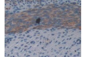 Detection of FIL1d in Mouse Uterus Tissue using Polyclonal Antibody to Interleukin 1 Delta (FIL1d) (FIL1d antibody  (AA 1-156))