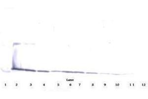 Image no. 4 for anti-Interleukin 17A (IL17A) antibody (ABIN465127) (Interleukin 17a antibody)