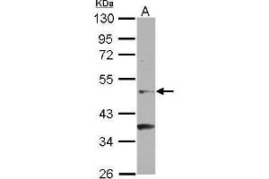 WB Image Sample (30 ug of whole cell lysate) A: NT2D1 10% SDS PAGE antibody diluted at 1:500 (NR6A1 antibody  (C-Term))