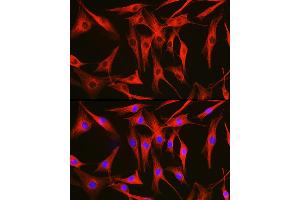Immunofluorescence analysis of NIH/3T3 cells using Alpha-tubulin (ubiquitous) chain antibody (ABIN7271033) at dilution of 1:100. (TUBA1B antibody  (AA 1-451))