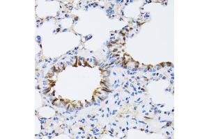 Immunohistochemistry of paraffin-embedded rat lung using N antibody (ABIN6129932, ABIN6144318, ABIN6144319 and ABIN6222781) at dilution of 1:100 (40x lens). (NAA10 antibody  (AA 161-235))