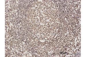 Immunoperoxidase of purified MaxPab antibody to OLIG3 on formalin-fixed paraffin-embedded human lymph node. (OLIG3 antibody  (AA 1-272))