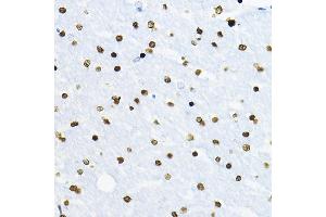 Immunohistochemistry of paraffin-embedded rat brain using SOX10 Rabbit pAb (ABIN7270568) at dilution of 1:100 (40x lens). (SOX10 antibody  (AA 200-300))