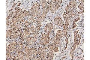 IHC analysis of LPP using anti-LPP antibody (ABIN7599606). (LPP antibody  (AA 10-572))