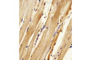 (ABIN6242157 and ABIN6578316) staining Zebrafish ak2 in zebra fish body tissue sections by Immunohistochemistry (IHC-P - paraformaldehyde-fixed, paraffin-embedded sections). (Adenylate Kinase 2 antibody  (N-Term))