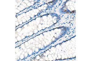 Immunohistochemistry of paraffin-embedded Human liver (negative control sample) using Y antibody (ABIN7271418) at dilution of 1:1000 (40x lens). (YAP1 antibody)