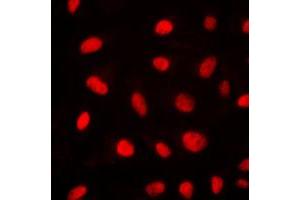 Immunofluorescent analysis of ELK1 staining in NIH3T3 cells.