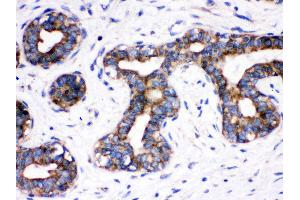 Immunohistochemistry (Paraffin-embedded Sections) (IHC (p)) image for anti-Cell Division Cycle 6 Homolog (S. Cerevisiae) (CDC6) (AA 147-549) antibody (ABIN3043500) (CDC6 antibody  (AA 147-549))