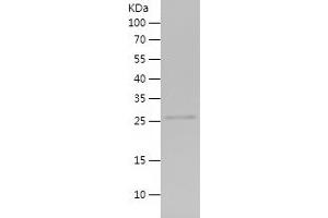 Western Blotting (WB) image for Synovial Sarcoma Translocation Gene On Chromosome 18-Like 1 (SS18L1) (AA 282-396) protein (His tag) (ABIN7282348) (SS18L1 Protein (AA 282-396) (His tag))