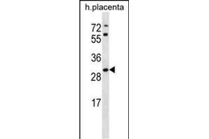 STARD4 antibody  (N-Term)