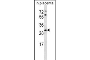STARD4 Antibody (N-term) (ABIN656728 and ABIN2845952) western blot analysis in human placenta tissue lysates (35 μg/lane).