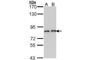 WB Image Sample (30 ug of whole cell lysate) A: Hep G2 , B: Molt-4 , 7. (FAP antibody)