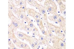 Immunohistochemistry of paraffin-embedded Human liver damage using PSMF1 Polyclonal Antibody at dilution of 1:100 (40x lens). (PSMF1 antibody)