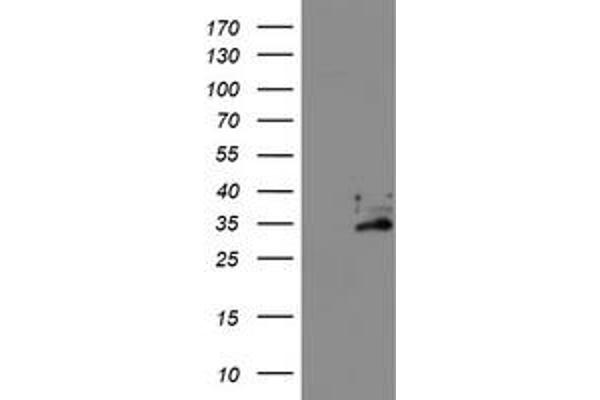 EXOSC7 antibody