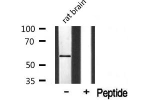 Western blot analysis of Cytochrome P450 1A2 Antibody expression in rat brain tissue lysates.