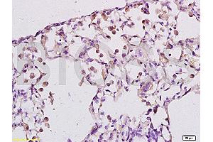 Formalin-fixed and paraffin embedded rat lung labeled with Anti-LTB4-R1/BLTR Polyclonal Antibody, Unconjugated (ABIN748628) at 1:200 followed by conjugation to the secondary antibody and DAB staining. (Leukotriene B4 Receptor/BLT antibody  (AA 101-200))
