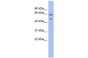 GNL3 antibody used at 1 ug/ml to detect target protein.