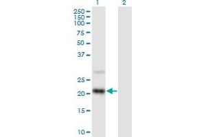 Western Blot analysis of RAX2 expression in transfected 293T cell line by RAX2 MaxPab polyclonal antibody. (RAX2 antibody  (AA 1-184))