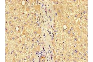 Immunohistochemistry of paraffin-embedded human liver tissue using ABIN7147871 at dilution of 1:100 (Claudin 1 antibody  (AA 24-161))